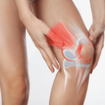 Navigating Meniscal Tears: Understanding the Injury and Treatment Options